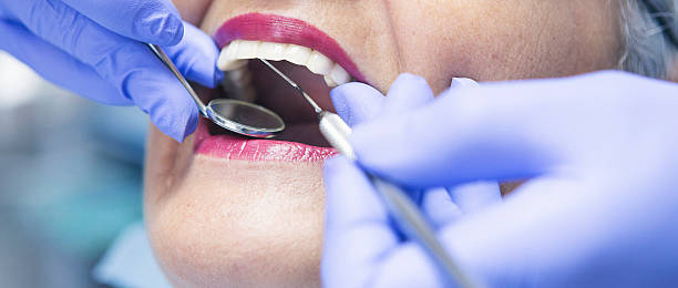 Best Emergency Root Canal Treatment in Sturgis, KY